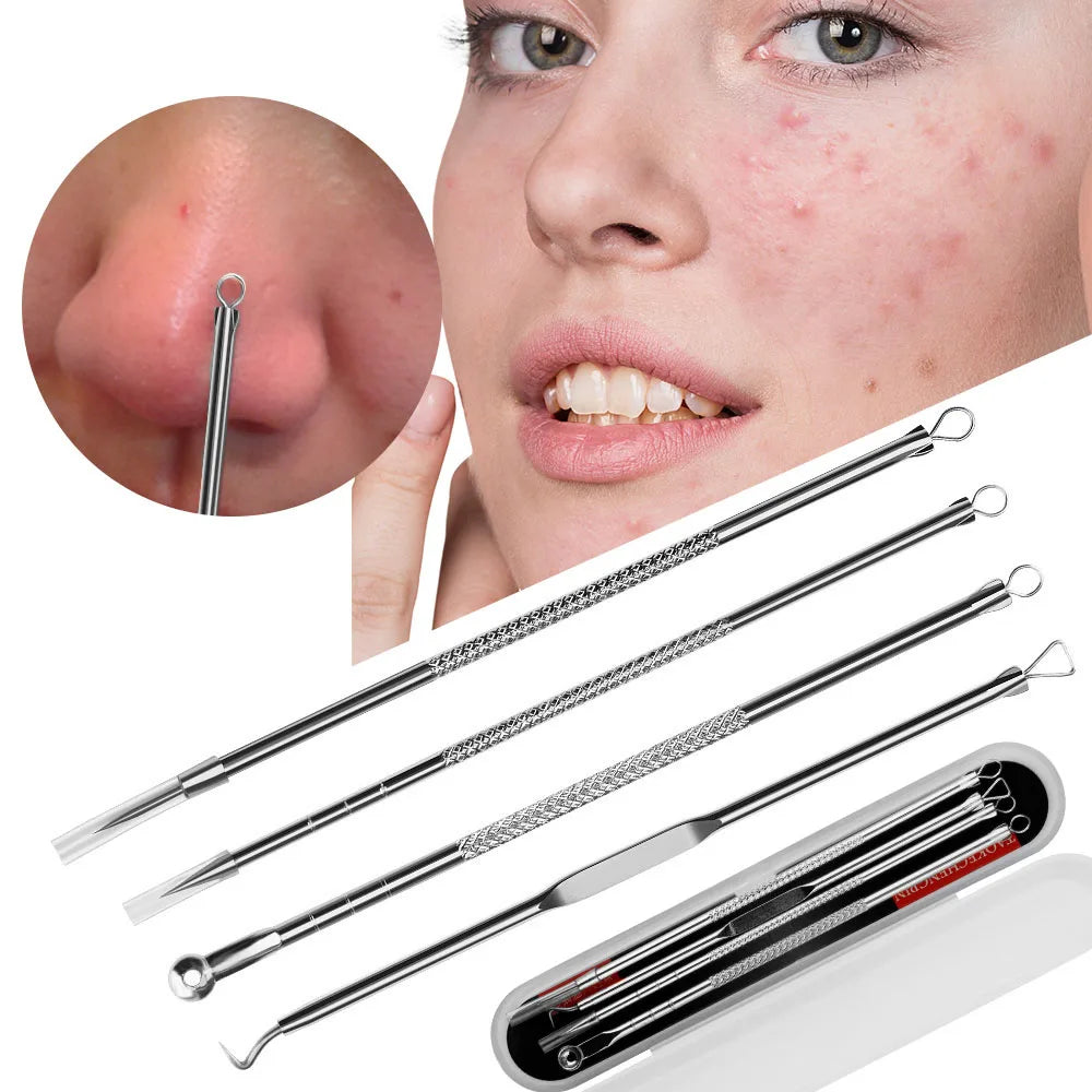 4Pcs Blackhead Acne Remover Set